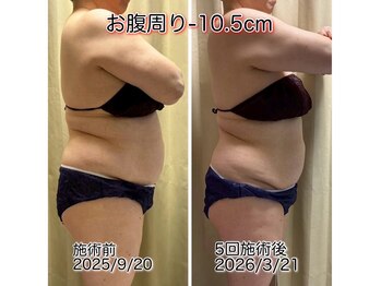 クールスパ(COOL SPA)/100CUPチャレンジ