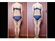 ナコズ エステティック(Nakos esthetic)の写真