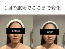 エスポワール(espoir)