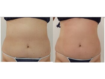 クレール アオヤマ(CLAIRE AOYAMA)/【50代3回】運動苦手でも痩せる