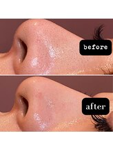 エステティックサロン S/毛穴ケア