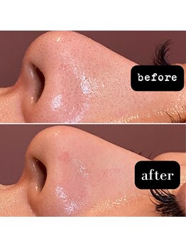 エステティックサロン S/毛穴ケア