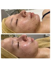 アミューラ(AMULA)/インディバ＆マッサージ(^-^)