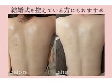 フォーウーマン(for woman)/背中ピーリング＋セルサー 