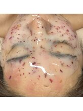 ララルアナ(Lara luana)/ジェリーマスクで女度アップ