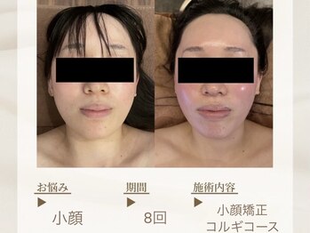 ベレガ 京都店(BELEGA)/◆BeforeAfter◆