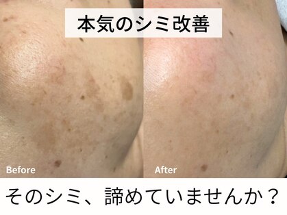 ルーチェ(LUCE)の写真