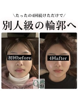 キュープ 松戸店(Qpu)の写真/松戸の隠れ家サロン♪完全個室でゆったり！極上オイルコースで癒やしのひとときを◎