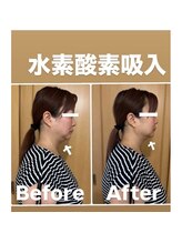 ヨサパーク メンソーレ(YOSA PARK)/水素吸入