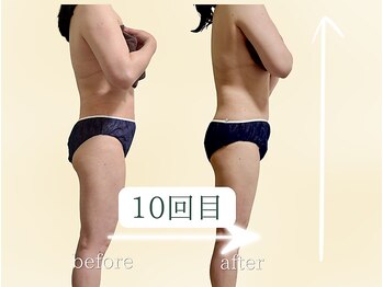 ヨサパーク リボーン(YOSA PARK Reborn)の写真/痩せてボディラインも真っ直ぐ美しく,若々しく健康的に痩せていきます★小顔,毛穴ケア,美白,美肌ケアも叶う