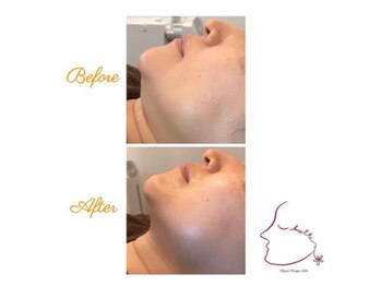 ウルエッテ(UluEtte)/