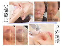 ムーンリーフアシヤ(MoonLeaf ashiya)の雰囲気（人気の小顔矯正＆毛穴洗浄でお顔スッキリ）