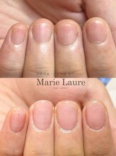マリーロール 淀屋橋本店(Marie Laure)/自爪育成/深爪矯正/ネイルケア