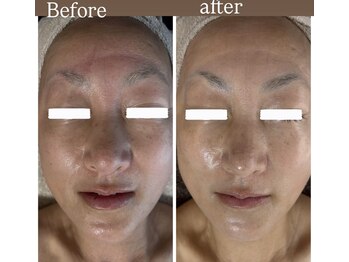 マリエンドリー/若見え