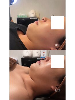 モア(more.)/コルギ×レモンボトル