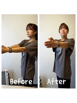  ネクターン ルミエール(Nekturn' Lumiere)/背中の柔らかさ改善/肩こり改善