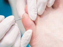 銀座巻き爪補正店/副爪