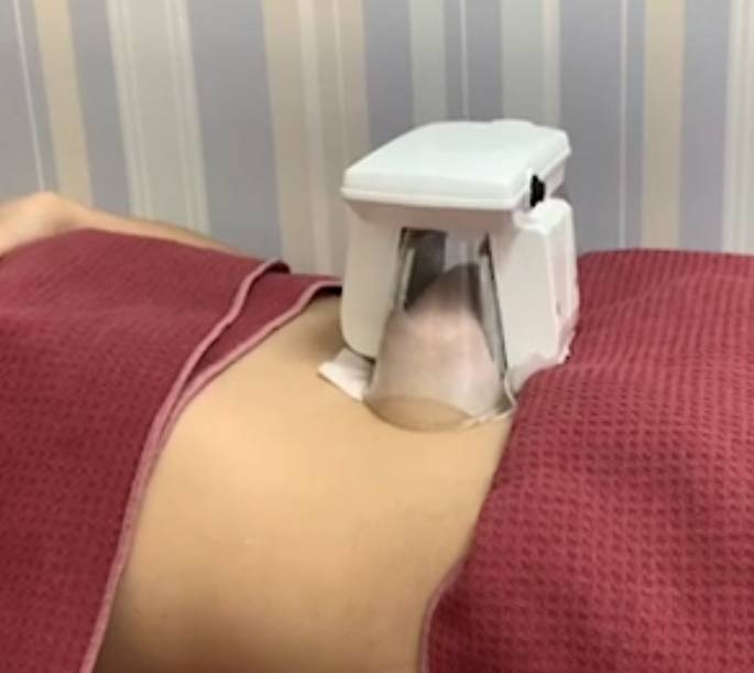 【ご新規様限定】溶解液導入＆脂肪冷却2カップLED光全身コース