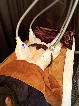 ブルースター(Blue Star)/脂肪冷却4カップ施術風景