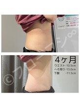 フローフシ∞/【集中痩せ】4ヶ月で-10.5cm