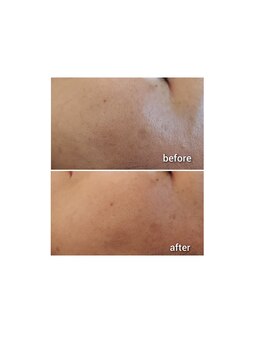 ケイリー(kaylee)/マグマハーブ