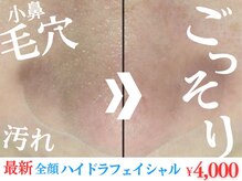 チル(chill)