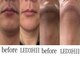 ラクツル(楽ツル24)の写真