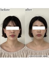 ヴェルシック(Belchic)/直後からここまで変化