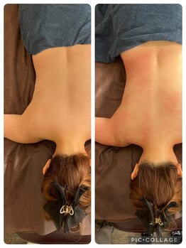 シュシュ(chouchou)/before after