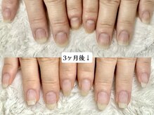 グレースレディ 神戸北店/０２．お伺いとご提案