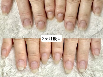 グレースレディ 神戸北店/０２．お伺いとご提案