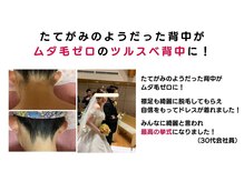 スウィートボディ(Sweetbody)の雰囲気（挙式前に脱毛されて背中がキレイになり喜んでもらえました！）