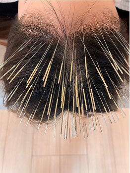 経堂鍼灸整体院の写真/【本格育毛促進メニュー導入】鍼と幹細胞エキスで頭皮環境を整え、本来の健やかな髪を育む力をサポート◎
