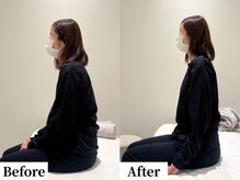 ソレア(Solea)/首こり・肩こり改善1回目