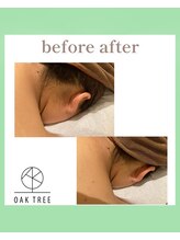 オークツリー(oak tree)/Before After