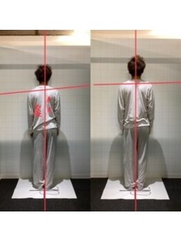 ラグ整体院(rag整体院)/姿勢改善30代　8回でこの効果！