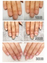 グレースレディ 神戸北店/