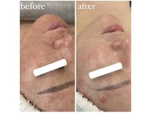 サロン ド ビューティージュエル(salon de beauty JEWEL)/プラズマニア