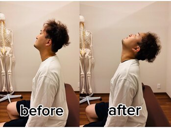 オン鍼灸整体院(ON鍼灸整体院)/整体&鍼灸/劇的ビフォーアフター