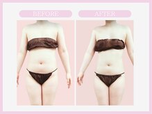 スリムライン 盛岡店(The Slim Line)/before→after