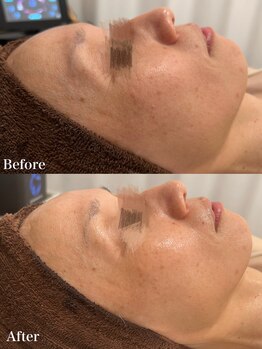 トータルビューティー ミミ(Total Beauty mimi)/