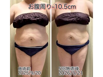 クールスパ(COOL SPA)/100CUPチャレンジ