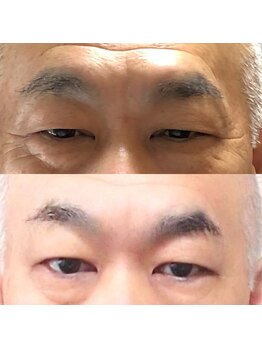 アキ/まるで別人!初回お試し2日後