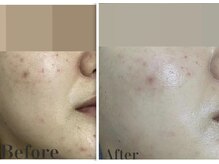 サロン ド レイ(Salon de Rei)/