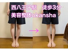 美容整体サロン オオカンシャ(okansha)/O脚Before→after