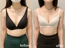 ティアモ(Ti Amo)/Before/After