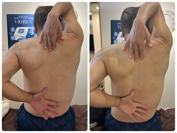 ピンクマジック(PINKMAGIC)/リリースカッター施術ビフォアフ