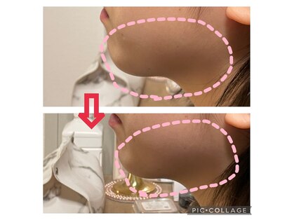 ルカシエ(Le Cacie)の写真