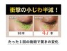 【シワ/ハリ/美白】ベビースキン導入で根本改善[インストラクター施術]60分