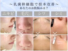 リンフェイス 池袋店(RIN FACE)
